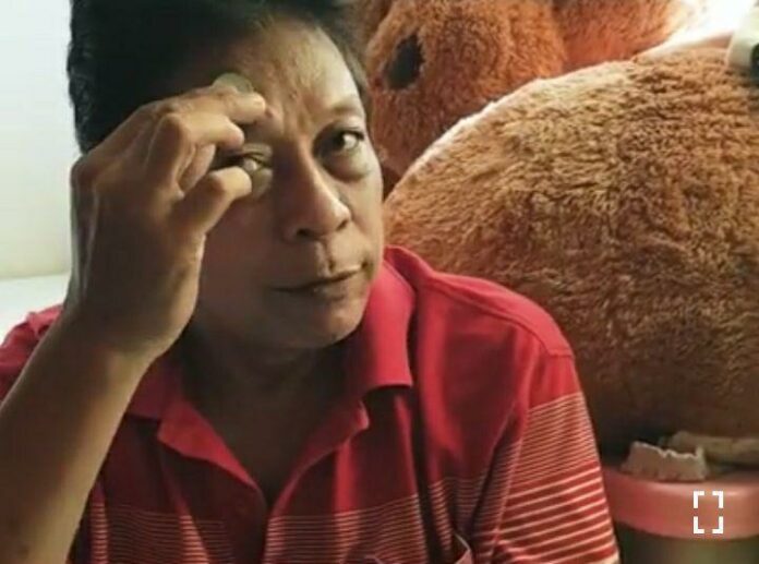 edi dhosa roronoa zoro